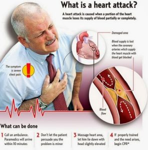 Heart attack symptoms and causes