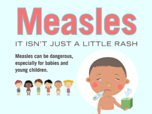 Measles Outbreak 2019