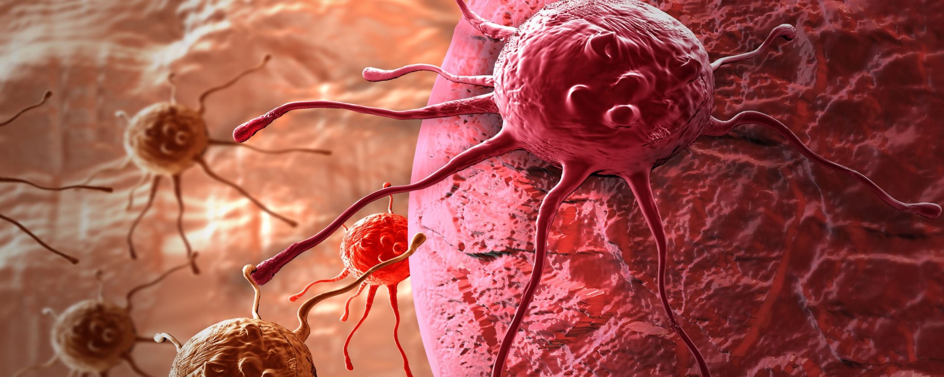 How a New Cancer 'Vaccine' Fights Tumors Throughout the Body