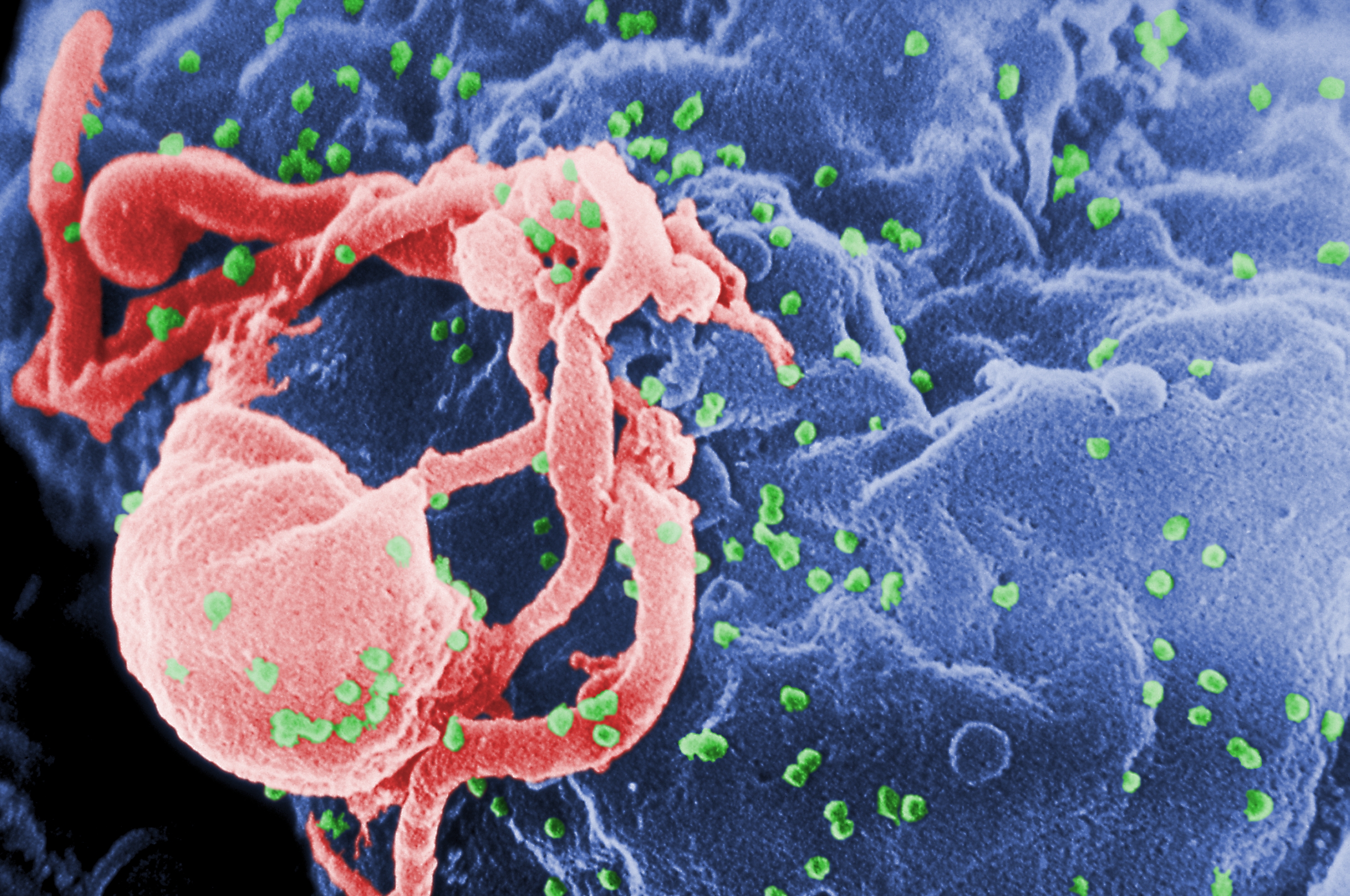cure for HIV vaccine