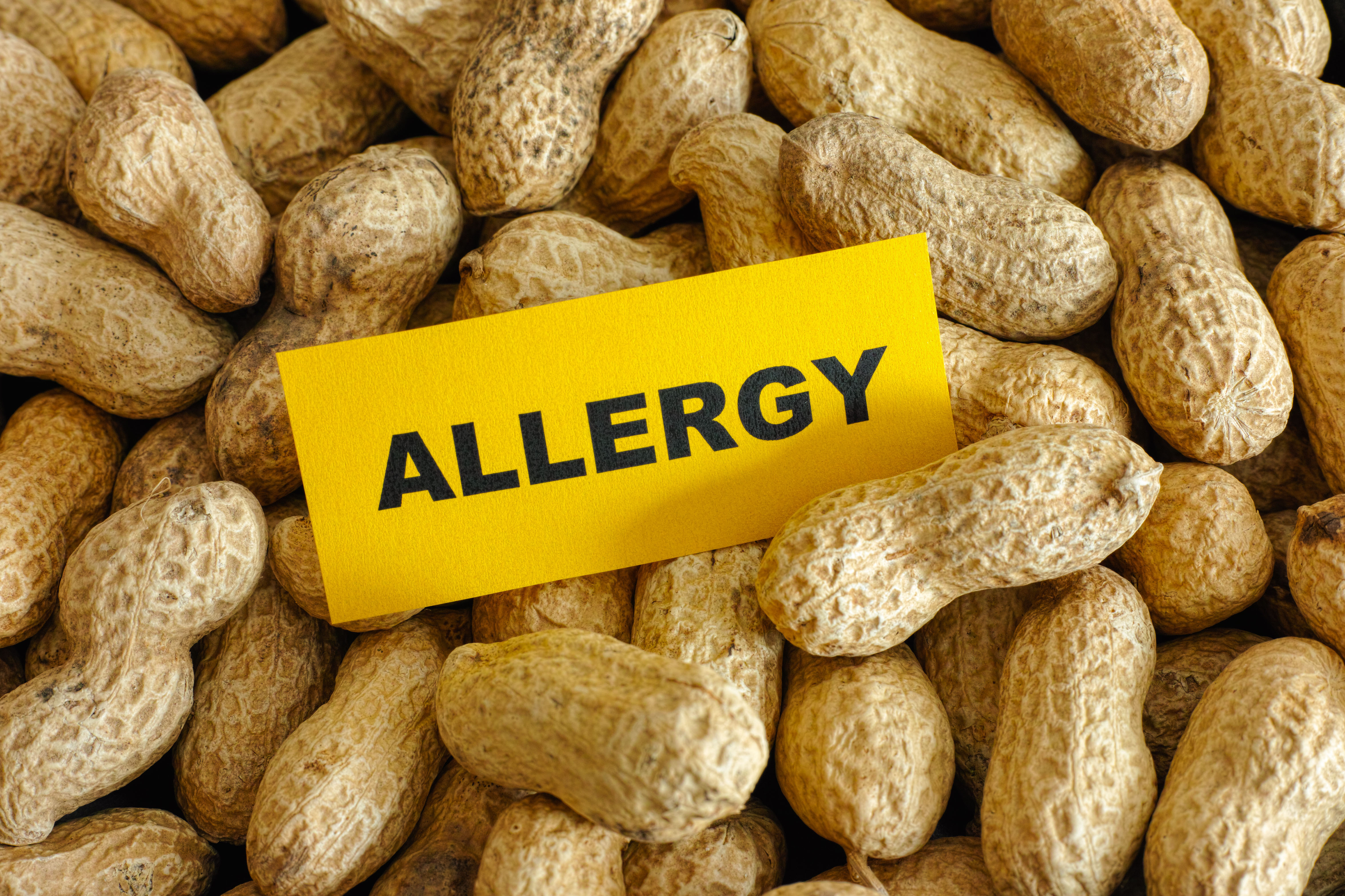 Food Allergy symptoms and cure