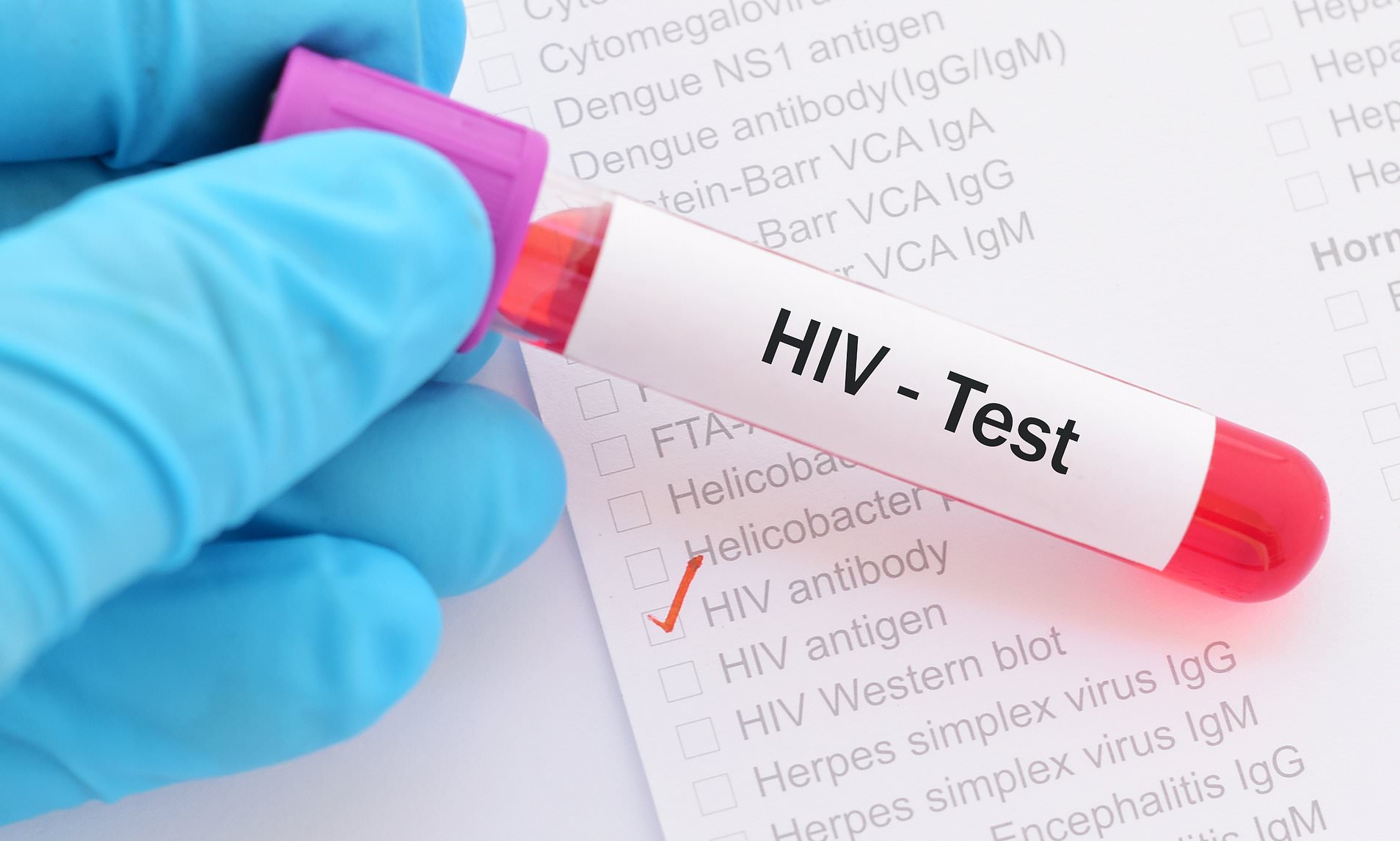 Why Early Detection of HIV is Important