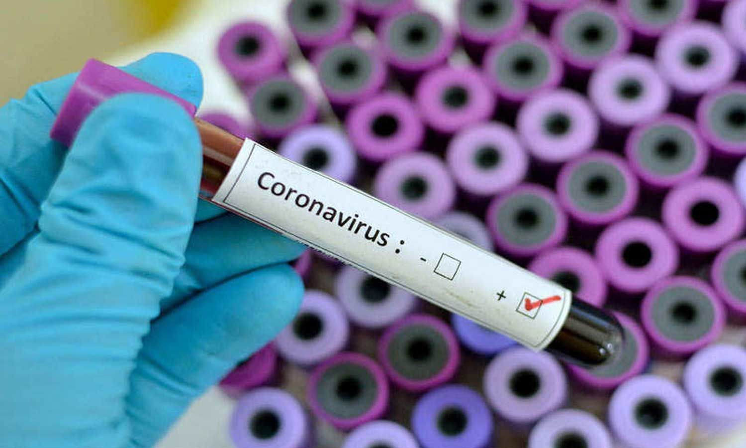 Coronavirus Vaccine Research and Development Timeline